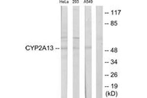 Western Blotting (WB) image for anti-Cytochrome P450, Family 2, Subfamily A, Polypeptide 13 (CYP2A13) (AA 311-360) antibody (ABIN2889942) (CYP2A13 anticorps  (AA 311-360))