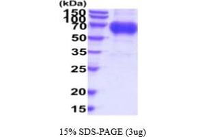 Osteoactivin (GPNMB) (AA 22-474) protein (His tag)
