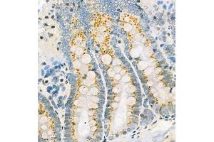 Immunohistochemistry analysis of paraffin embedded rat ileum using CYPIW1 (ABIN7073674) at dilution of 1: 500 (CYP2W1 anticorps)