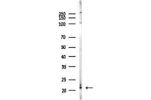 Western blot analysis of lysates from PC12 cells(LPS,4h treatment), using  Antibody at 1/1000 dilution.