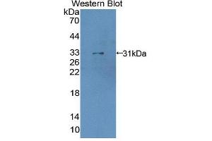 Western blot analysis of the recombinant protein. (LDOC1 anticorps  (AA 1-146))