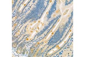 Immunohistochemistry of paraffin embedded mouse small intestine using Znt1 (ABIN7075672) at dilution of 1:650 (300x lens) (SLC30A1 anticorps)