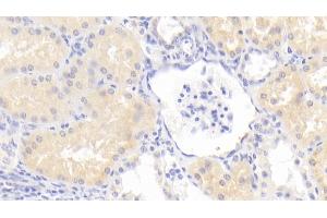 anti-GM2 Ganglioside Activator (GM2A) (AA 24-193) antibody