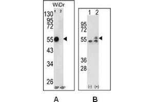 A: Western blot analysis of ATP5B Antibody (Center) Cat. (ATP Synthase Subunit beta (AtpB) (AA 142-171), (Middle Region), (Subunit beta) anticorps)