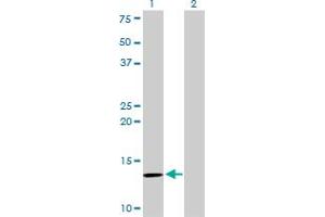 Western Blot analysis of B2M expression in transfected 293T cell line by B2M monoclonal antibody (M01), clone 3F9-2C2.