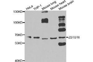 Western blot analysis of extracts of various cell lines, using ZBTB16 antibody.