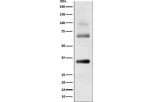Western blot analysis of Loricrin expression in Human skin cell lysate.