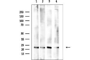 Western blot analysis of lysates from various samples, using SOD2/MnSOD Mouse Monoclonal Antibody at 1/1000 dilution.
