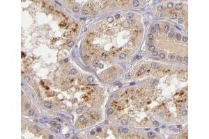 ABIN6266579 at 1/200 staining human kidney tissue sections by IHC-P.