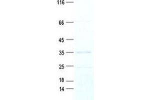 Validation with Western Blot