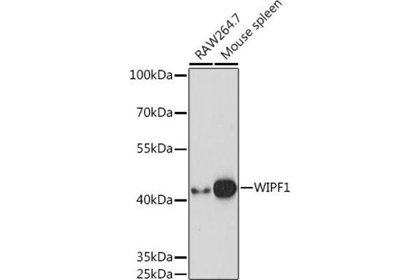 WIPF1 抗体  (AA 400-500)