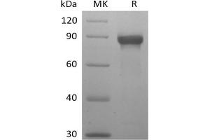 Western Blotting (WB) image for Sialic Acid Binding Ig-Like Lectin 8 (SIGLEC8) protein (mFc Tag) (ABIN7319860) (SIGLEC8 Protein (mFc Tag))