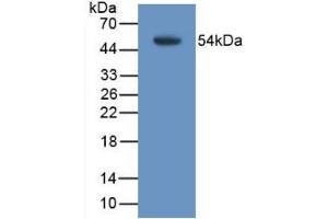 Detection of Recombinant TMEM27, Mouse using Monoclonal Antibody to Transmembrane Protein 27 (TMEM27)