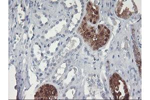 Immunohistochemical staining of paraffin-embedded Human Kidney tissue using anti-GBA3 mouse monoclonal antibody.