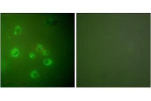 Immunofluorescence analysis of COS7 cells, using GRP78 antibody (ABIN5976417). (GRP78 anticorps  (C-Term))