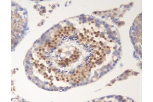 IHC analysis of SOX6 using anti-SOX6 antibody (ABIN7603012). (SOX6 anticorps  (Middle Region))