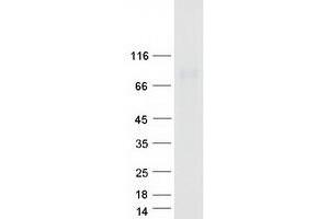 Validation with Western Blot