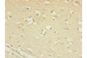 Immunohistochemistry of paraffin-embedded human brain tissue using ABIN7147450 at dilution of 1:100 (CSPP1 anticorps  (AA 997-1256))