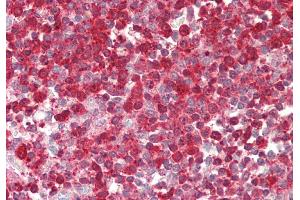 Rabbit Anti-PFN1 antibody  Formalin Fixed Paraffin Embedded Tissue: Human Spleen Primary antibody Concentration: 1:100 Secondary Antibody: Donkey anti-Rabbit-Cy3 Secondary Antibody Concentration: 1:200 Magnification: 20x Exposure Time: 0. (PFN1 anticorps  (N-Term))