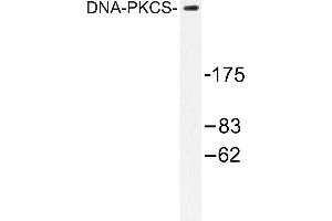 Image no. 2 for anti-Protein Kinase, DNA-Activated, Catalytic Polypeptide (PRKDC) antibody (ABIN265386)