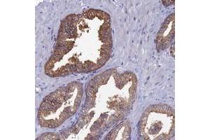Immunohistochemical staining of human prostate with TOMM20L polyclonal antibody  shows strong cytoplasmic positivity in glandular cells. (TOMM20L anticorps)