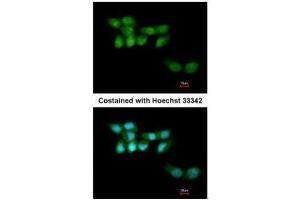 ICC/IF Image Immunofluorescence analysis of paraformaldehyde-fixed A431, using UVSSA antibody [N1N2], N-term , at 1:200 dilution. (UVSSA/KIAA1530 anticorps  (N-Term))
