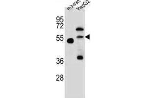 Western Blotting (WB) image for anti-Nitric Oxide Synthase Trafficker (NOSTRIN) antibody (ABIN2997567)