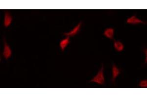 ABIN6267579 staining HuvEc by IF/ICC.