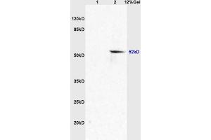 Lane 1: mouse embryo lysates Lane 2: mouse brain lysates probed with Anti AVPR2 Polyclonal Antibody, Unconjugated (ABIN705746) at 1:200 in 4 °C.