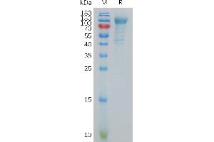 Human C Protein, His Tag on SDS-PAGE under reducing condition.