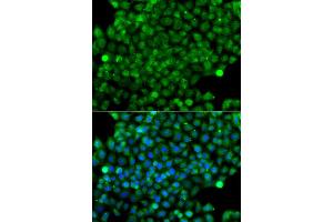 Immunofluorescence analysis of A549 cell using CFHR3 antibody. (CFHR3 anticorps)