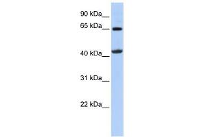 GATM antibody used at 1 ug/ml to detect target protein. (GATM anticorps)