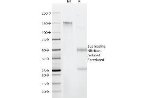 SDS-PAGE Analysis Purified CD6 Mouse Monoclonal Antibody (C6/372). (CD6 anticorps)