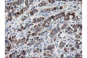 Image no. 3 for anti-Ribophorin 1 (RPN1) antibody (ABIN1500754)