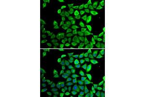 Immunofluorescence analysis of U2OS cells using PPID antibody (ABIN5974177). (PPID anticorps)