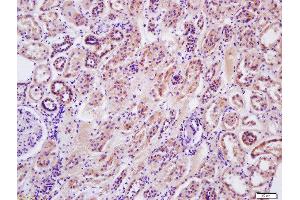 Formalin-fixed and paraffin embedded human kidney labeled with Anti-Arginase II Polyclonal Antibody, Unconjugated  at 1:200 followed by conjugation to the secondary antibody and DAB staining
