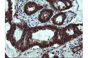 Image no. 2 for anti-Tubulin Folding Cofactor C (TBCC) antibody (ABIN1501323)