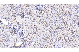 Detection of LDHB in Human Kidney Tissue using Polyclonal Antibody to Lactate Dehydrogenase B (LDHB)