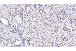 Detection of LDHB in Human Kidney Tissue using Polyclonal Antibody to Lactate Dehydrogenase B (LDHB) (LDHB anticorps  (AA 1-334))