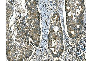 IHC analysis of RAB13 using anti-RAB13 antibody (ABIN7600599). (RAB13 anticorps  (AA 21-200))