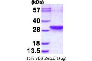 Image no. 1 for Leucine Zipper, Down-Regulated in Cancer 1-Like (LDOC1L) protein (His tag) (ABIN1098336)