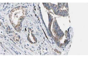ABIN6277641 at 1/100 staining Human prostate tissue by IHC-P. (ATIC anticorps  (C-Term))