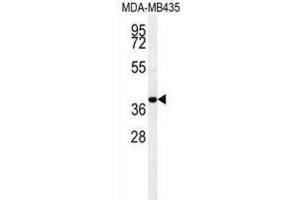Western Blotting (WB) image for anti-Chemokine (C-C Motif) Receptor 8 (CCR8) antibody (ABIN2995670) (CCR8 anticorps)