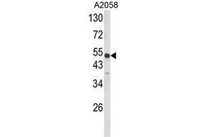 Western blot analysis of ANXA7 Antibody (Center) in A2058 cell line lysates (35ug/lane). (Annexin VII anticorps  (Middle Region))