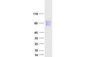Validation with Western Blot