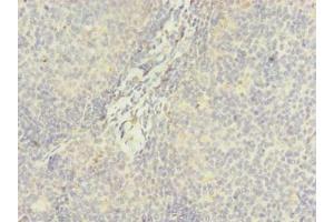 Immunohistochemistry of paraffin-embedded human tonsil tissue using ABIN7144990 at dilution of 1:100 (DDX42 anticorps  (AA 519-819))