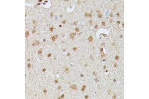 Immunohistochemistry of paraffin-embedded rat brain using IGHMBP2 antibody (ABIN7267848) at dilution of 1:100 (40x lens).