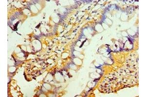 Immunohistochemistry of paraffin-embedded human small intestine tissue using ABIN7173851 at dilution of 1:100 (TACI anticorps  (AA 184-293))