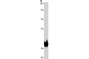 Western Blotting (WB) image for anti-Aspartoacylase (ASPA) antibody (ABIN2429545) (ASPA anticorps)
