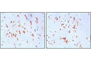 Immunohistochemical analysis of paraffin-embedded human brain tissues, showing cytoplasmic localization with DAB staining using FMR1 mouse mAb. (FMR1 anticorps)